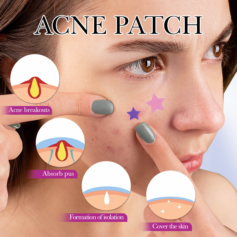 7/10/14Pcs Colorful Star Acne  - Skincare Qv incelemesi ve fiyatı