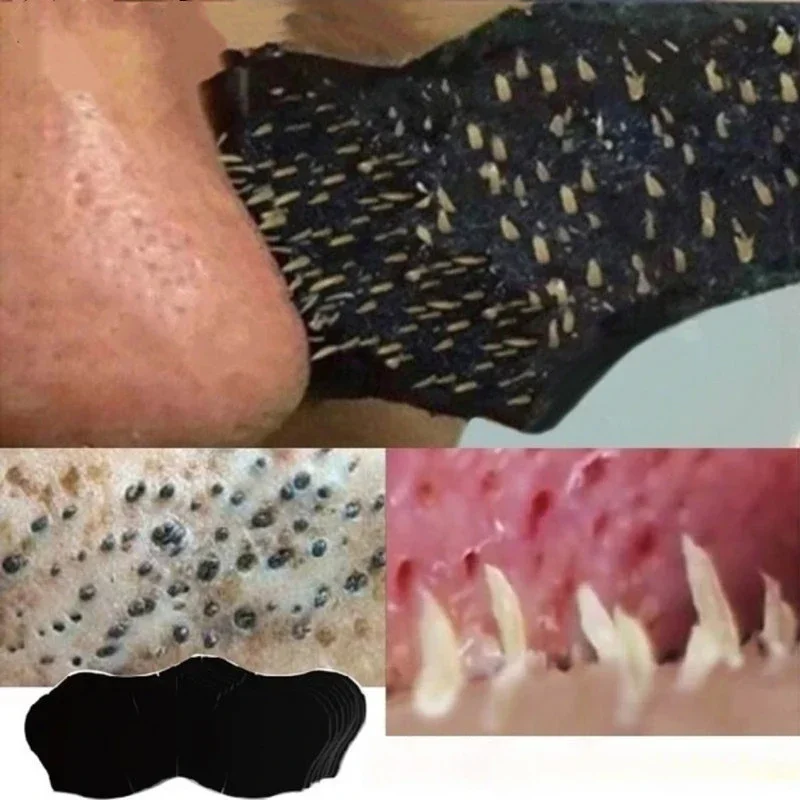 Unisex Blackhead Remove Mask N - Skincare Viral Tiktok incelemesi ve fiyatı