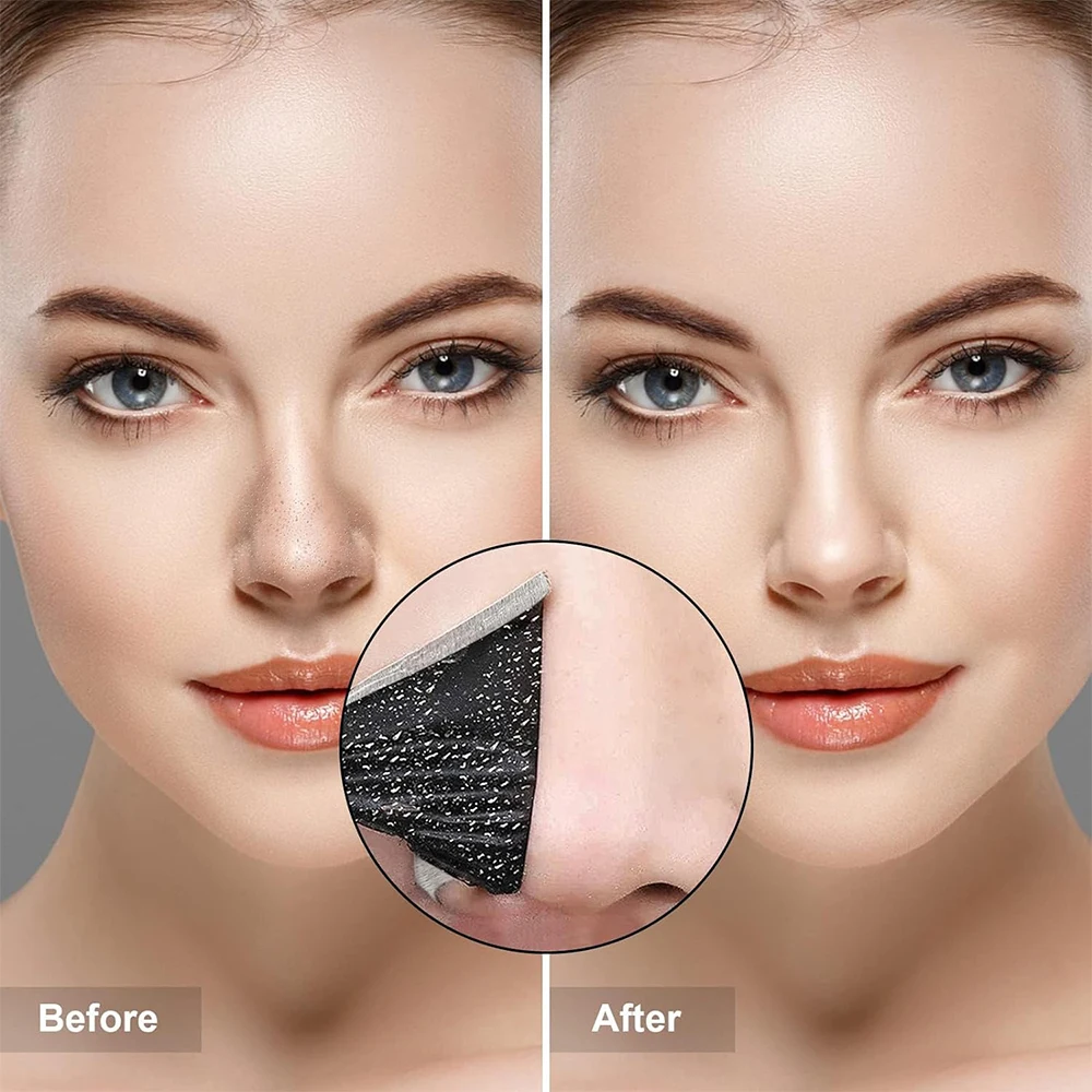 10PCS Unisex Blackhead Remove  - Skincare Viral Tiktok incelemesi ve fiyatı