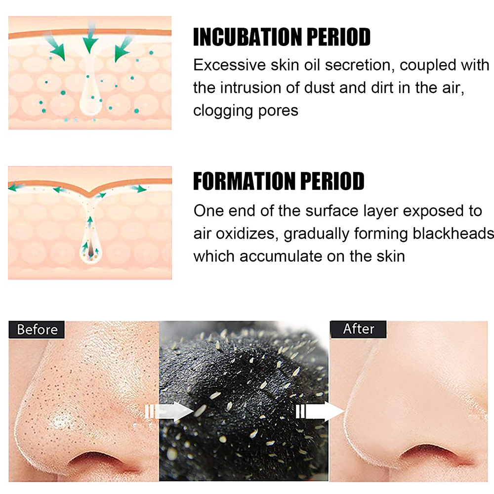 10PCS Unisex Blackhead Remove  - Skincare Viral Tiktok incelemesi ve fiyatı