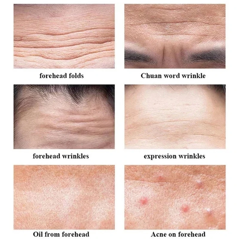 2/4/6pcs Anti-wrinkle Forehead - Skincare Viral Tiktok incelemesi ve fiyatı